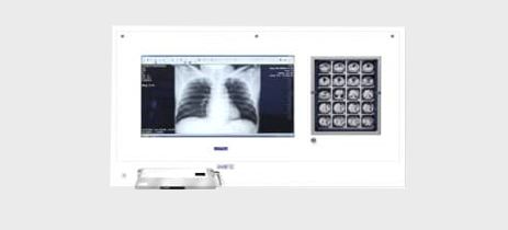 Stacje przeglądowe DiCO na salę operacyjną